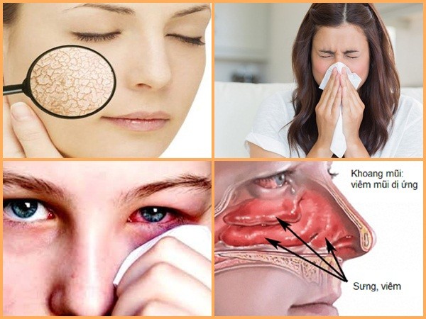 Thời điểm giao mùa và những "vị khách khó ưa" bất ngờ ghé thăm, phải làm sao?