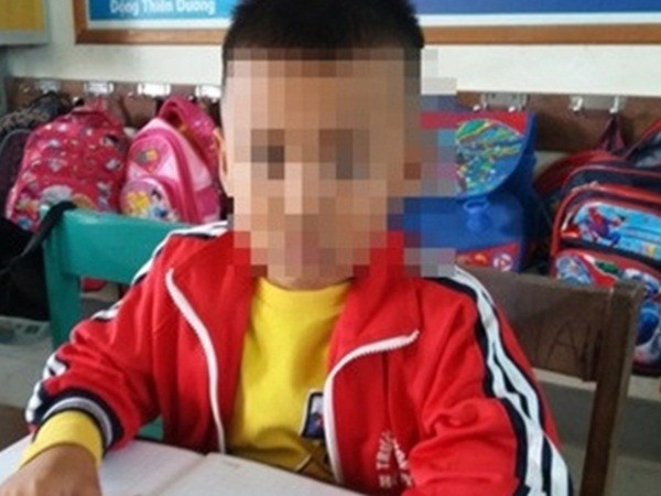 Quảng Bình: Học sinh bị cô giáo tát chấn động sọ não vì làm cả 2 đề kiểm tra