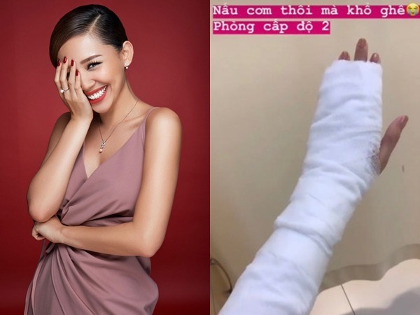 Các fan lo lắng khi Tóc Tiên phải băng bó vì bị phỏng cấp độ 2