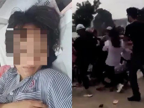 Quảng Ninh: Xác minh vụ nữ sinh bị đánh hội đồng đến tụ máu đầu