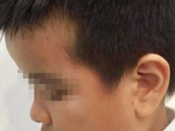 Cô giáo tát học sinh lớp 2 tím thái dương trong giờ kiểm tra học kỳ